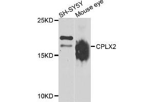 Western blot analysis of extracts of SH-SY5Y and mouse eye cell lines, using CPLX2 antibody. (CPLX2 antibody)
