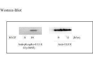 Image no. 4 for Epidermal Growth Factor Receptor (EGFR) ELISA Kit (ABIN625235) (EGFR ELISA Kit)