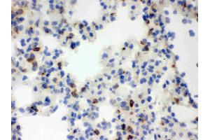 Immunohistochemistry (IHC) image for anti-Lipocalin 2 (LCN2) (AA 21-198) antibody (ABIN3043291)