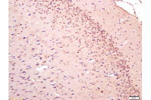 Formalin-fixed and paraffin embedded rat brain labeled with Anti-NFAT4 Polyclonal Antibody, Unconjugated (ABIN1387576) at 1:200 followed by conjugation to the secondary antibody and DAB staining (DLG3 antibody  (AA 501-600))
