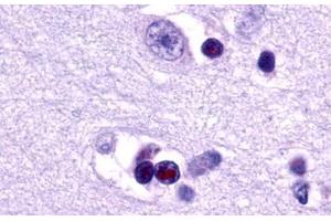 Image no. 1 for anti-Lysophosphatidic Acid Receptor 1 (LPAR1) (Cytoplasmic Domain) antibody (ABIN1048528) (LPAR1 antibody  (Cytoplasmic Domain))