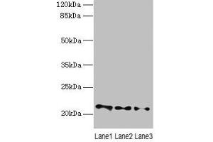 Western blot All lanes: VPS25 antibody at 3 μg/mL Lane 1: Mouse kidney tissue Lane 2: HL60 whole cell lysate Lane 3: THP-1 whole cell lysate Secondary Goat polyclonal to rabbit IgG at 1/10000 dilution Predicted band size: 21 kDa Observed band size: 21 kDa (VPS25 antibody  (AA 1-176))