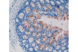 Used in DAB staining on fromalin fixed paraffin- embedded intestine tissue (GLMN antibody  (AA 294-549))