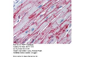 Immunohistochemistry (IHC) image for anti-Polyribonucleotide Nucleotidyltransferase 1 (PNPT1) (Middle Region) antibody (ABIN2776602) (PNPT1 antibody  (Middle Region))