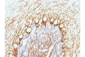 Formalin-fixed, paraffin-embedded human cerebellum stained with NF-H antibody (NE14). (NEFH antibody)