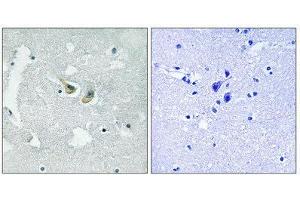 Immunohistochemistry (IHC) image for anti-Neutrophil Cytosol Factor 1 (NCF1) (pSer345) antibody (ABIN1847806) (NCF1 antibody  (pSer345))