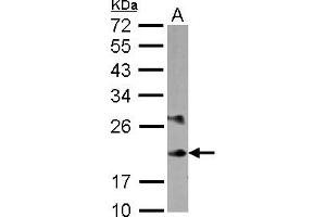 Western Blotting (WB) image for anti-Myosin, Light Chain 6B, Alkali, Smooth Muscle and Non-Muscle (MYL6B) (AA 1-208) antibody (ABIN1499618)