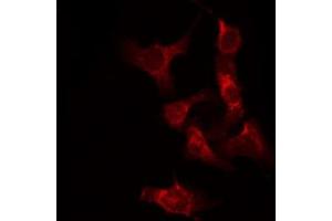 ABIN6267282 staining Hela by IF/ICC. (RAF1 antibody  (pSer338))