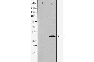Western blot analysis of extracts of mouse spleen tissue , using ATG5 antibody.