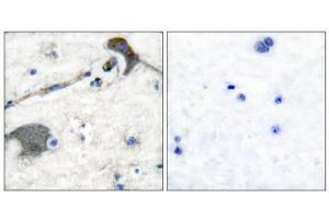Immunohistochemical analysis of paraffin-embedded human brain tissue, using RASH/RASK/RASN antibody (ABIN5976497). (RASH/RASK/RASN (N-Term) antibody)