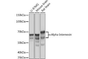 Western blot analysis of extracts of various cell lines, using Alpha Internexin Rabbit mAb (ABIN7268012) at 1:1000 dilution. (INA antibody)
