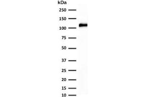 Western blot testing of human kidney lysate with recombinant Cadherin 16 antibody (clone KSCP2-2R). (Cadherin-16 antibody)