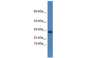Western Blot showing Ndufv2 antibody used at a concentration of 1. (NDUFV2 antibody  (C-Term))