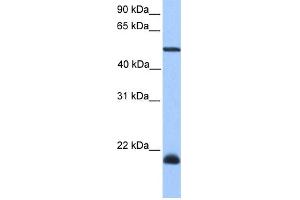 WB Suggested Anti-DYX1C1 Antibody Titration: 0. (DYX1C1 antibody  (C-Term))