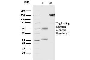 SDS-PAGE Analysis Purified Geminin Monoclonal Antibody (CPTC-GMMN-1). (Geminin antibody)