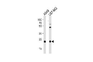 Western blot analysis of lysates from A549,U-87 MG cell line (from left to right),using CATL1 Antibody (heavy chain, Cleaved-Thr288)(ABIN6241621).
