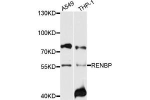 Western blot analysis of extracts of A549 and THP-1 cells, using RENBP antibody. (RENBP antibody)