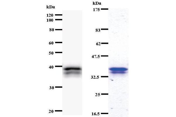 CHD6 antibody