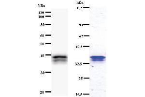 Left: CHD6 staining. (CHD6 antibody)