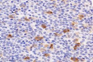 Immunohistochemistry analysis of paraffin-embedded mouse pituitary using,CHST8 (ABIN7073301) at dilution of 1: 3000 (CHST8 antibody)