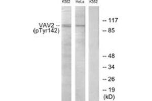 Western blot analysis of extracts from HeLa cells and K562 cells treated with TNF 20ng/ml 30', using VAV2 (Phospho-Tyr142) Antibody. (VAV2 antibody  (pTyr142))