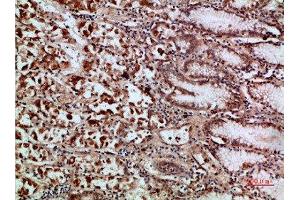 Immunohistochemical analysis of paraffin-embedded human-stomach, antibody was diluted at 1:200 (c-Rel antibody  (AA 491-540))