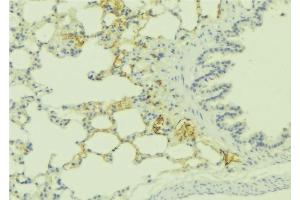 ABIN6275985 at 1/100 staining Human lung tissue by IHC-P. (Endothelin-1 Receptor antibody  (C-Term))