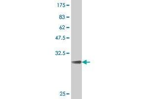 Western Blot detection against Immunogen (31. (KCNE2 antibody  (AA 73-123))