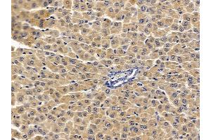 ABIN7094050 and ABIN7098094 at 1/100 staining rat liver tissue by IHC-P. (SOAT2 antibody  (C-Term))