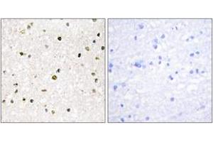 Immunohistochemistry analysis of paraffin-embedded human brain tissue, using AKAP11 Antibody.