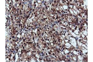 Image no. 5 for anti-Dual Specificity Phosphatase 23 (DUSP23) antibody (ABIN1497930) (DUSP23 antibody)