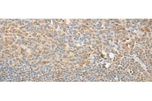 Immunohistochemistry of paraffin-embedded Human tonsil tissue using PSMD12 Polyclonal Antibody at dilution of 1:40(x200) (PSMD12 antibody)