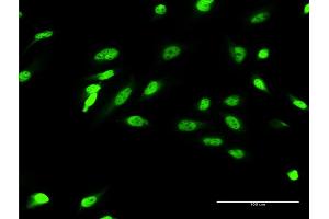 Immunofluorescence of monoclonal antibody to ZIC4 on HeLa cell. (ZIC4 antibody  (AA 1-90))