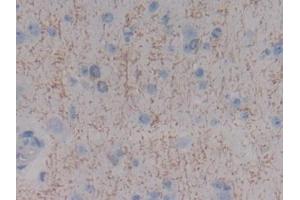 Detection of MBP in Human Cerebrum Tissue using Polyclonal Antibody to Myelin Basic Protein (MBP) (MBP antibody  (AA 135-190))