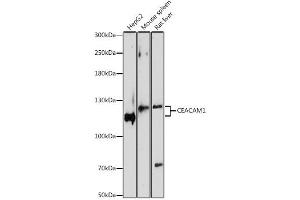 Western blot analysis of extracts of various cell lines, using CEACAM1 antibody. (CEACAM1 antibody)