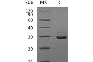 Western Blotting (WB) image for V-Set and Immunoglobulin Domain Containing 8 (VSIG8) protein (His tag) (ABIN7320683) (VSIG8 Protein (His tag))