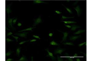 Immunofluorescence of monoclonal antibody to LYPLA1 on HeLa cell.