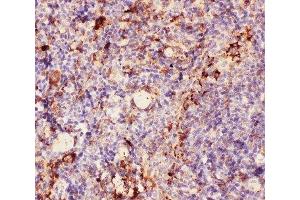 IHC-P: MAC-1 antibody testing of mouse spleen tissue (Integrin beta 2 antibody  (AA 17-382))