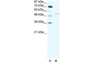 WB Suggested Anti-SMAD5 Antibody   Titration: 2. (SMAD5 antibody  (Middle Region))