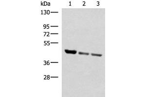 Western blot analysis of Human fetal liver tissue PC-3 and A172 cell lysates using SCCPDH Polyclonal Antibody at dilution of 1:1000