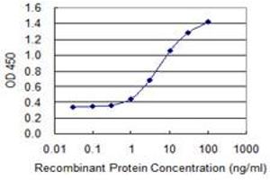 Detection limit for recombinant GST tagged ZNF398 is 0. (ZNF398 antibody  (AA 1-90))