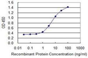 Detection limit for recombinant GST tagged ZNF398 is 0. (ZNF398 antibody  (AA 1-90))