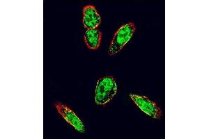 Confocal immunofluorescent analysis of SRC Antibody (N-term) (ABIN392107 and ABIN2841859) with  cell followed by Alexa Fluor 488-conjugated goat anti-rabbit lgG (green). (Src antibody  (N-Term))