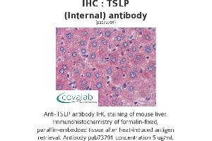 Image no. 1 for anti-Thymic Stromal Lymphopoietin (TSLP) (Internal Region) antibody (ABIN1740423) (Thymic Stromal Lymphopoietin antibody  (Internal Region))