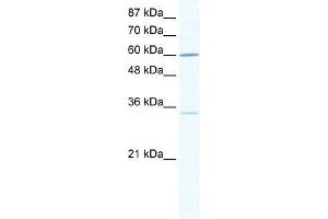 Western Blot showing ZNF668 antibody used at a concentration of 1-2 ug/ml to detect its target protein. (ZNF668 antibody  (N-Term))