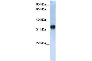 ZCCHC17 antibody used at 1 ug/ml to detect target protein. (ZCCHC17 antibody  (C-Term))