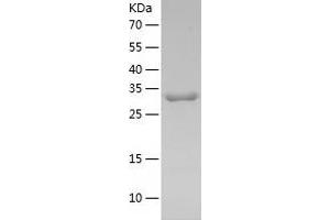 Western Blotting (WB) image for Melanoma Antigen Family A, 3 (MAGEA3) (AA 1-314) protein (His tag) (ABIN7286160) (MAGEA3 Protein (AA 1-314) (His tag))