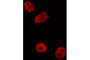 ABIN6268870 staining A-431 cells by IF/ICC. (TFAP2A antibody  (C-Term))