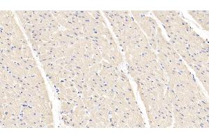 Immunohistochemistry (IHC) image for anti-Hypoxia Inducible Factor 1, alpha Subunit (Basic Helix-Loop-Helix Transcription Factor) (HIF1A) (AA 45-180) antibody (ABIN7437086)
