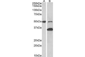 ABIN2563878 (1µg/ml) staining of Mouse fetal (A) and adult (B) Brain lysates (35µg protein in RIPA buffer). (MKRN1 antibody  (AA 105-118))
